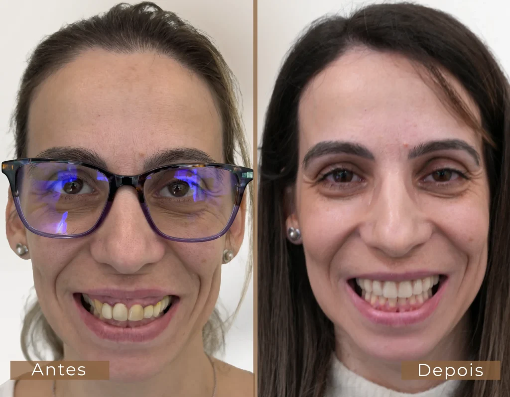 antes-depoiis-1-1-scaled-1-1024x798