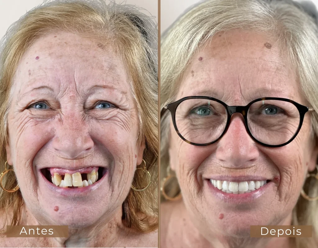 antes-depois-2-scaled-1-1024x798