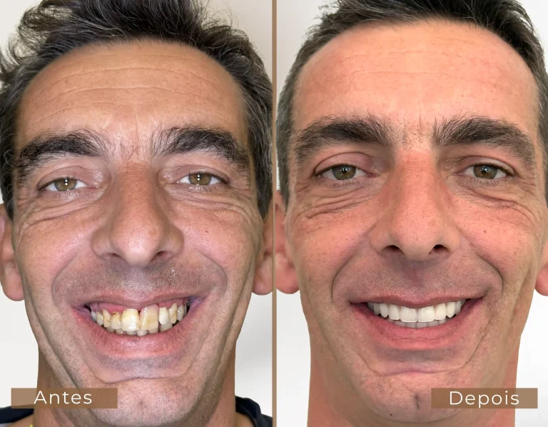 antes-depois-22-1-scaled-1-768x598